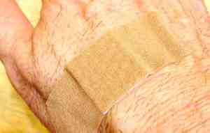 Minor Cuts Can Become Serious Infections 